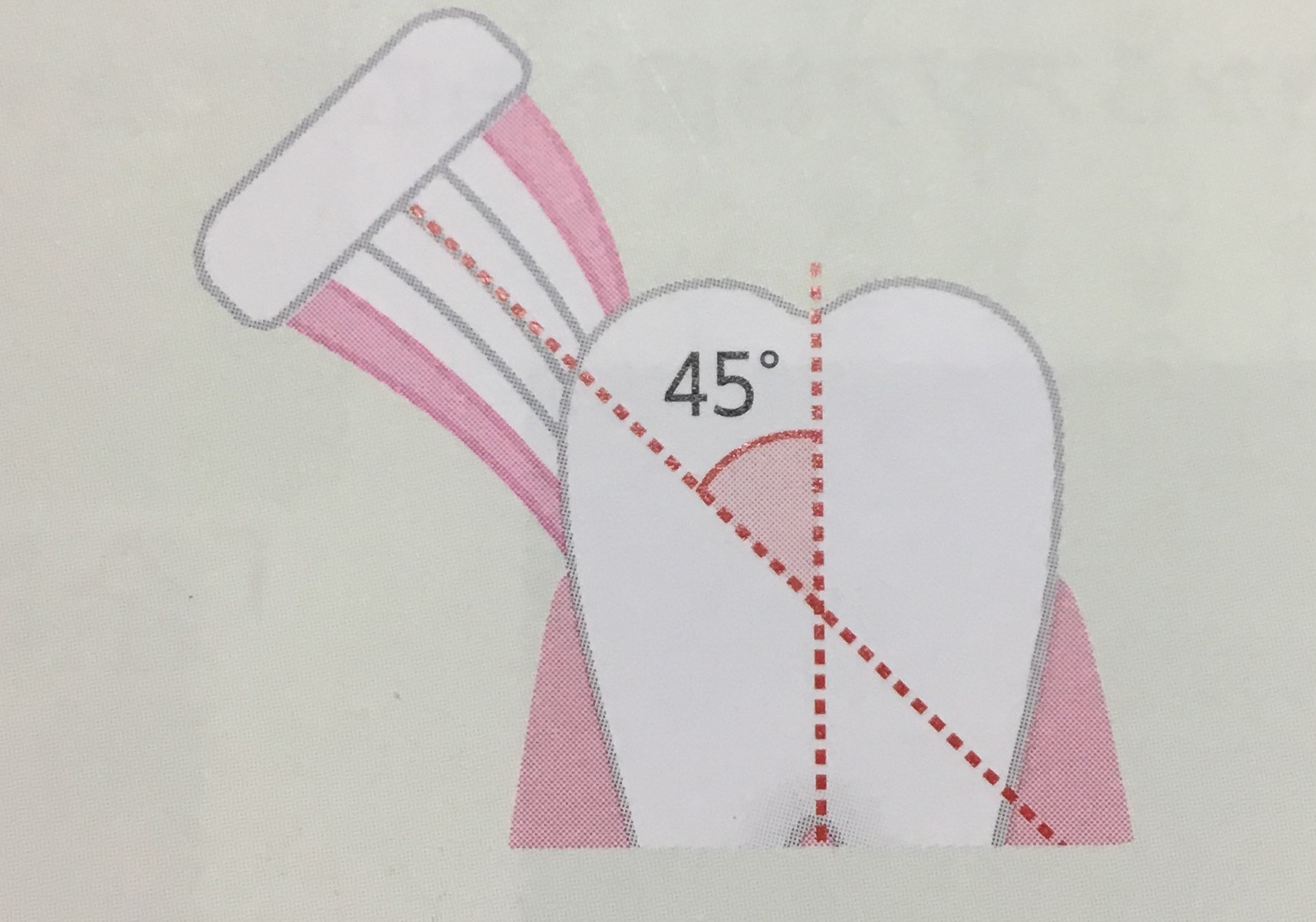 歯ブラシは45度に当てる