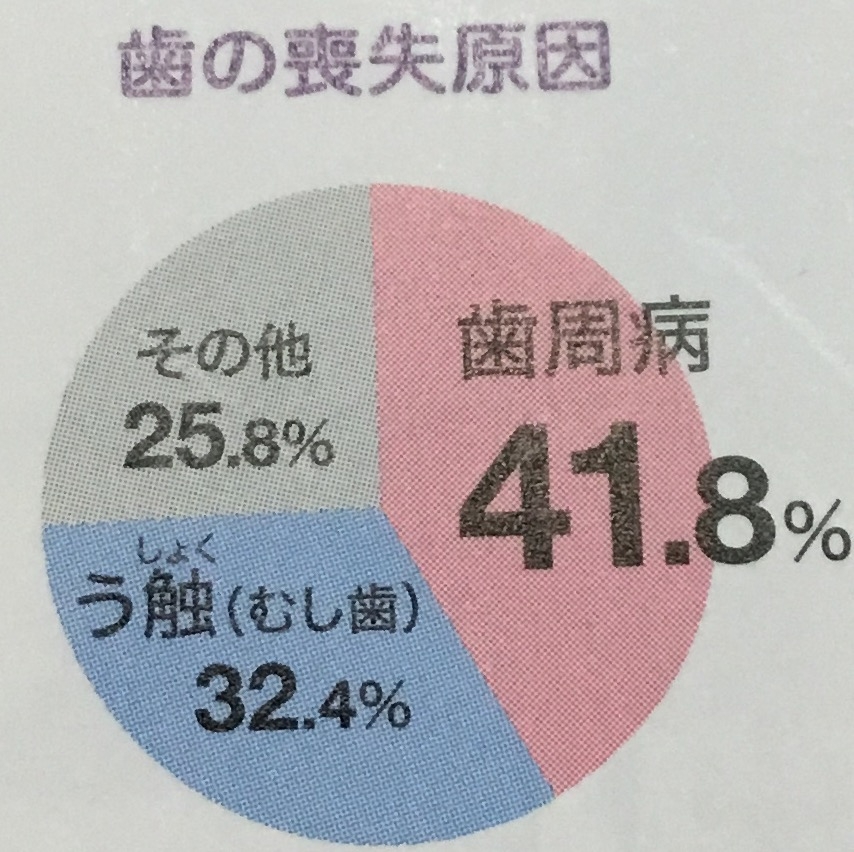 歯周病にきずくサインはあるの？