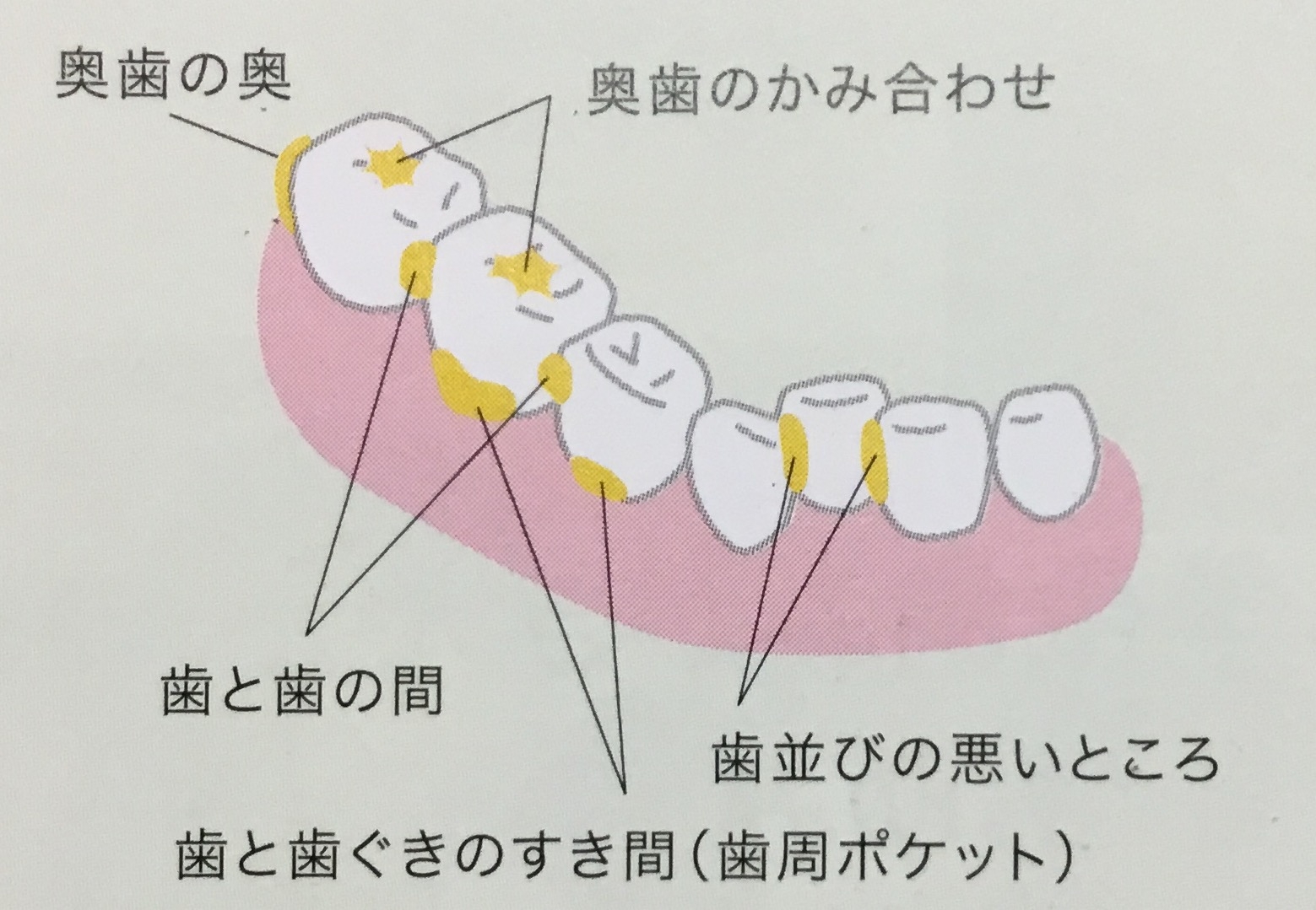 歯垢が残りやすいところを知ろう