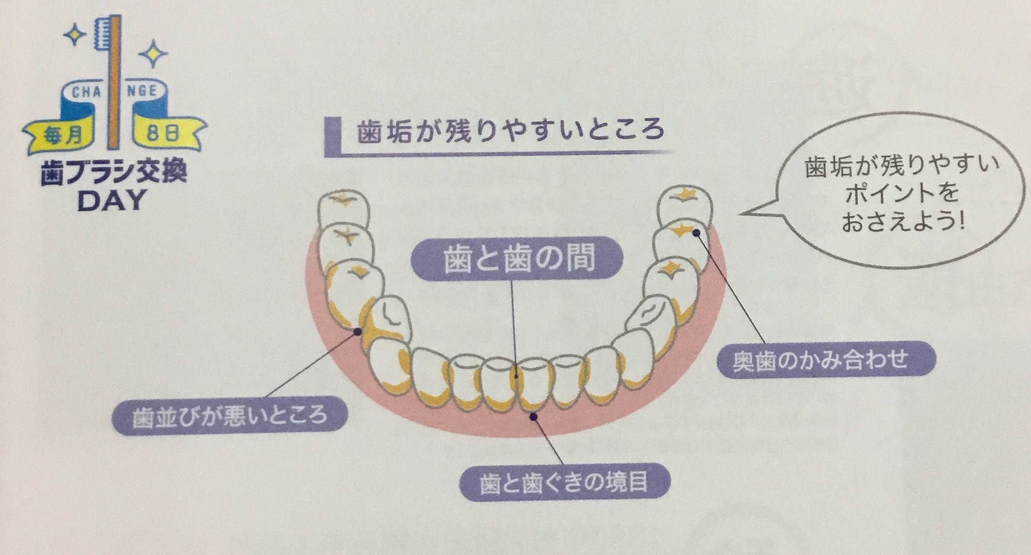 磨き残し