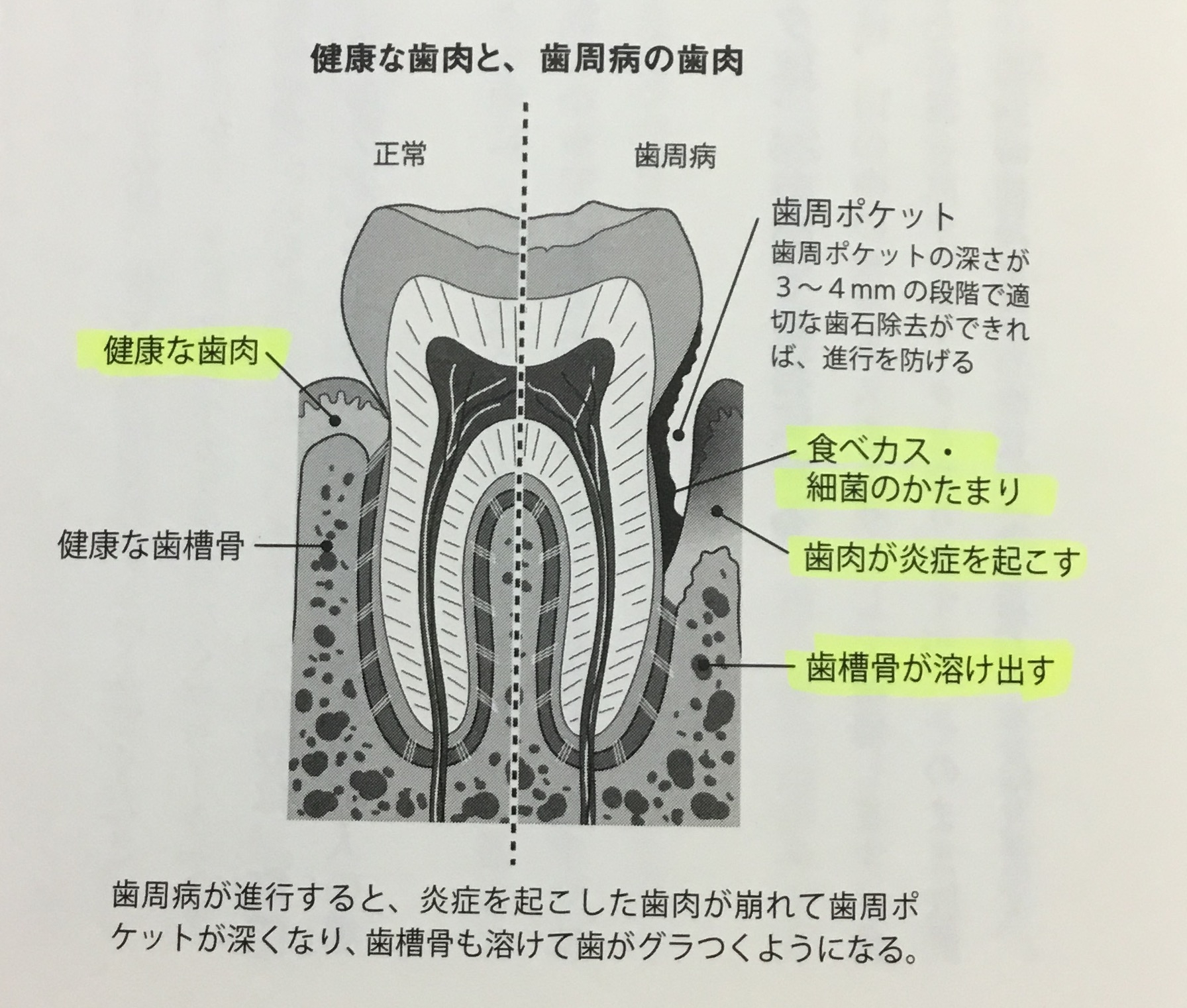 個