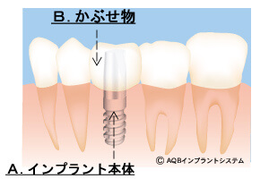 平均的な直し方