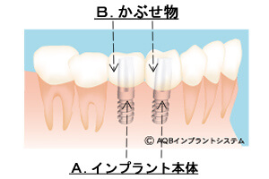平均的な直し方
